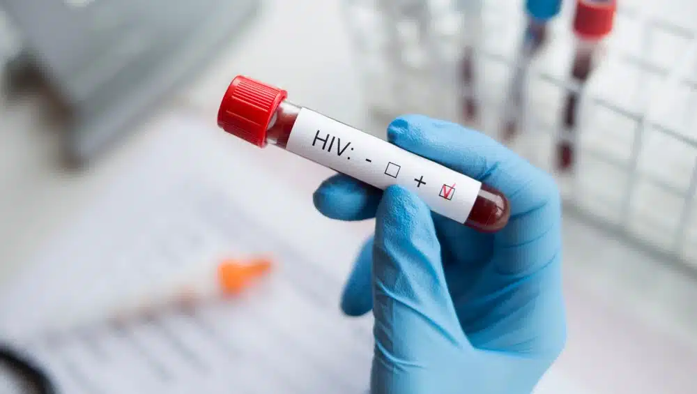 hiv-aids.jpg